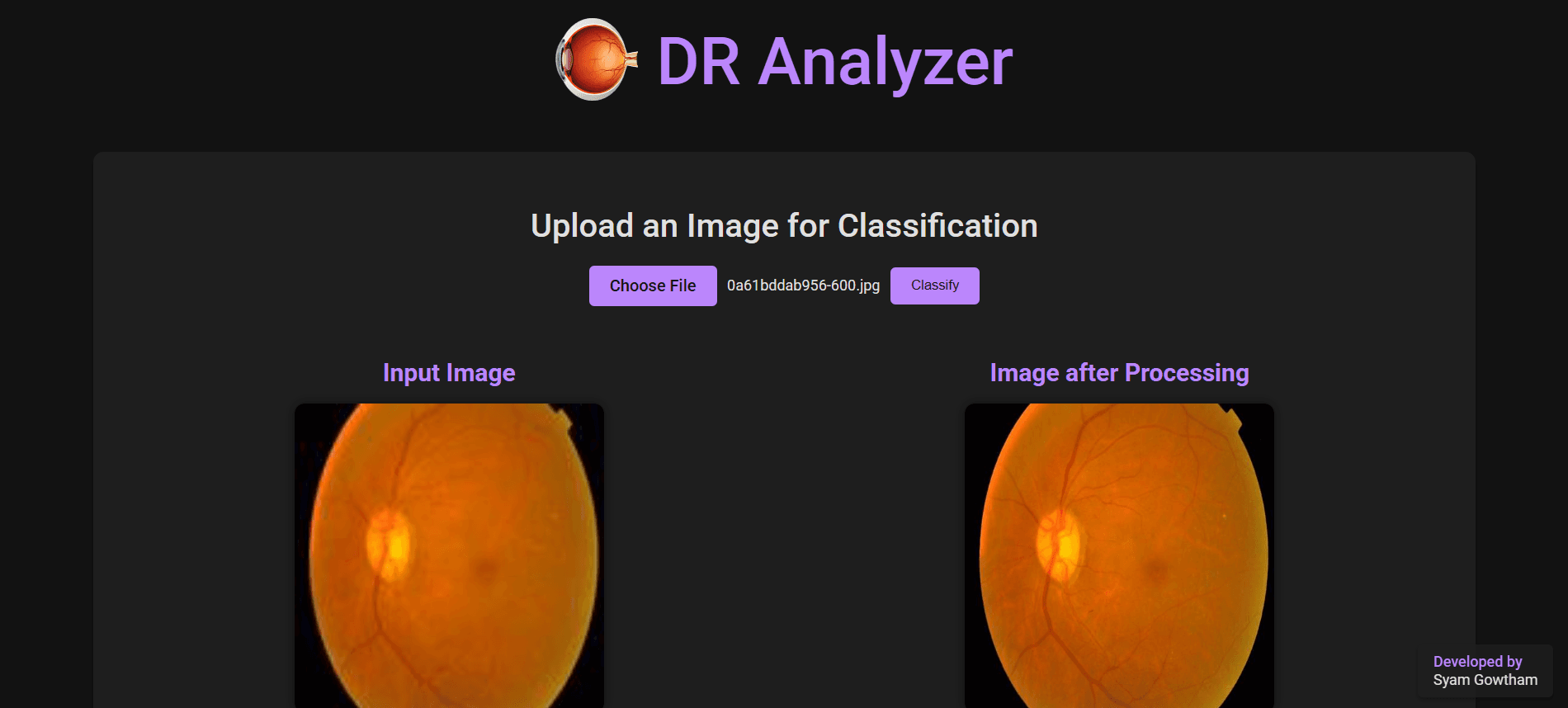 Diabetic Retinopathy Detection System